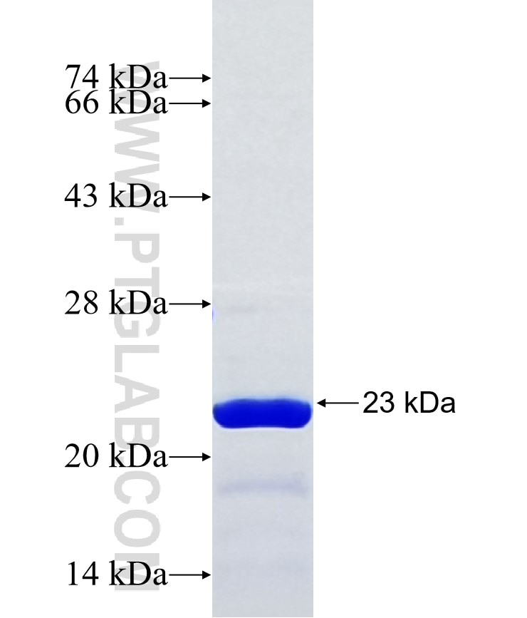 SIK2 fusion protein Ag38348 SDS-PAGE
