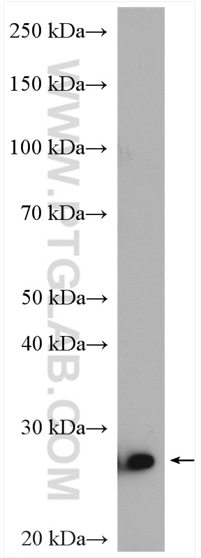 Western Blot (WB) analysis of HEK-293 cells using SIKE1 Polyclonal antibody (22432-1-AP)