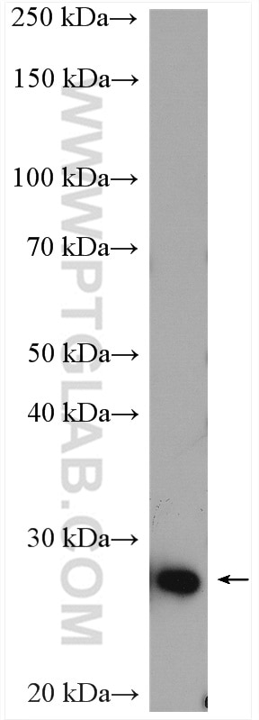 Western Blot (WB) analysis of SH-SY5Y cells using SIKE1 Polyclonal antibody (22432-1-AP)