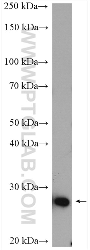 WB analysis of SH-SY5Y using 22432-1-AP