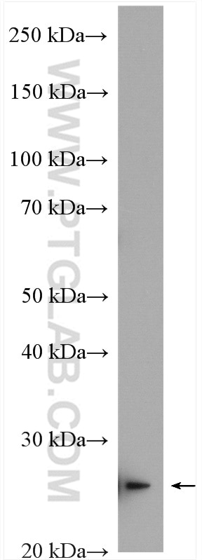 Western Blot (WB) analysis of MCF-7 cells using SIKE1 Polyclonal antibody (22432-1-AP)