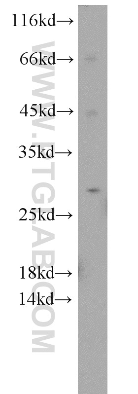 Western Blot (WB) analysis of mouse brain tissue using SIKE1 Polyclonal antibody (22432-1-AP)