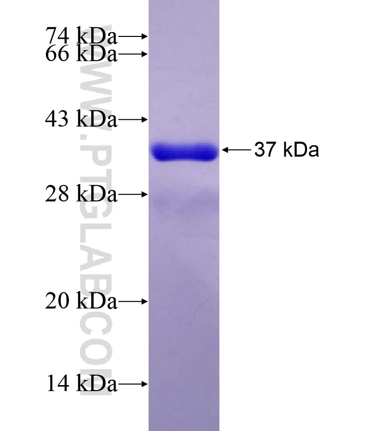 SIKE1 fusion protein Ag18196 SDS-PAGE