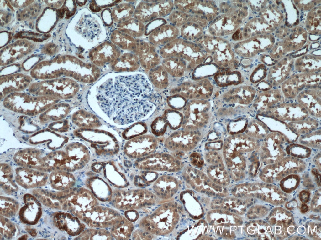 Immunohistochemistry (IHC) staining of human kidney tissue using SIL1 Polyclonal antibody (24110-1-AP)