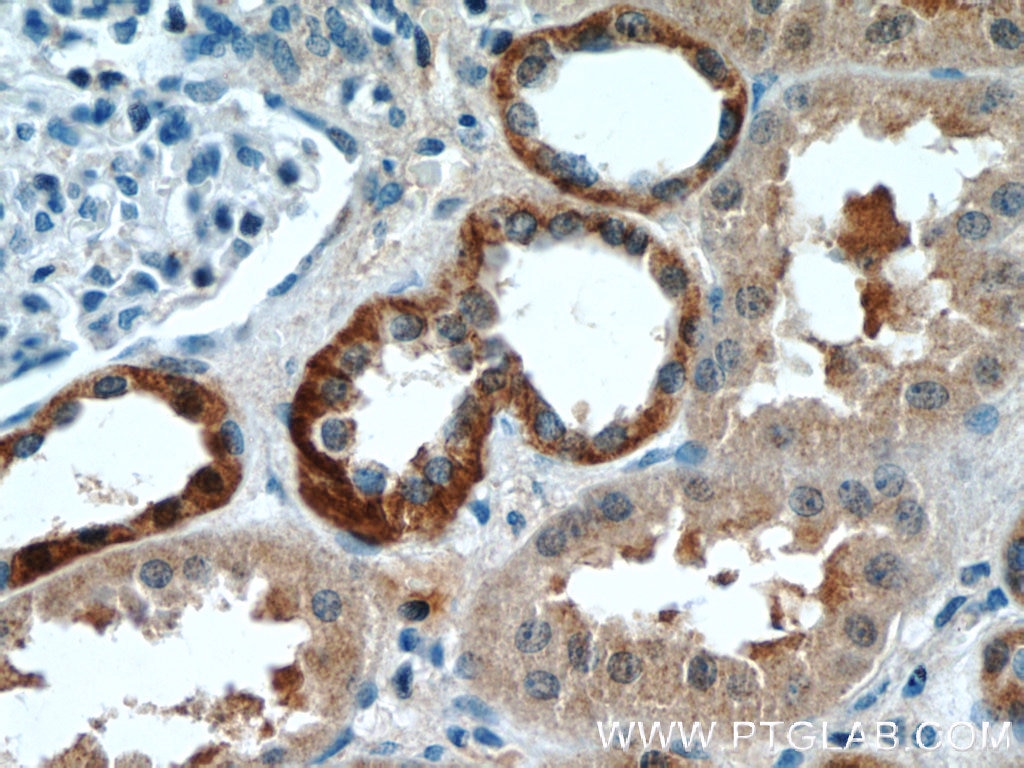 Immunohistochemistry (IHC) staining of human kidney tissue using SIL1 Polyclonal antibody (24110-1-AP)