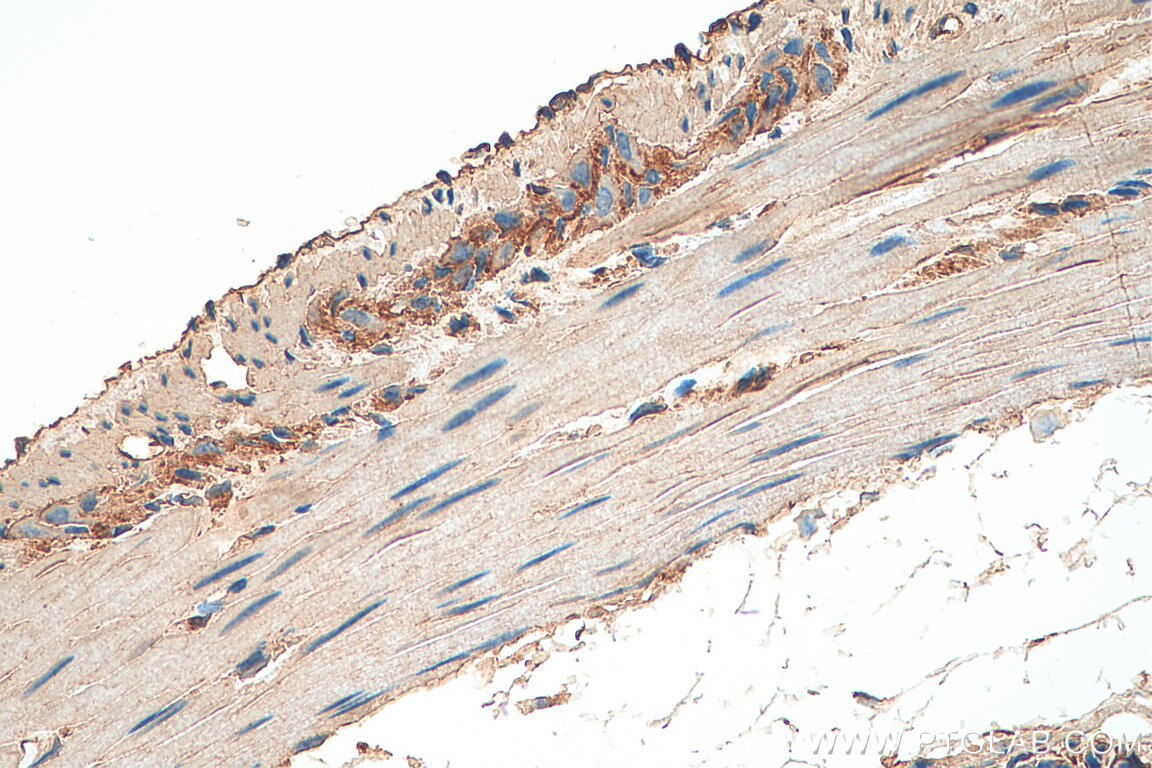 Immunohistochemistry (IHC) staining of mouse colon tissue using SIL1 Polyclonal antibody (24110-1-AP)