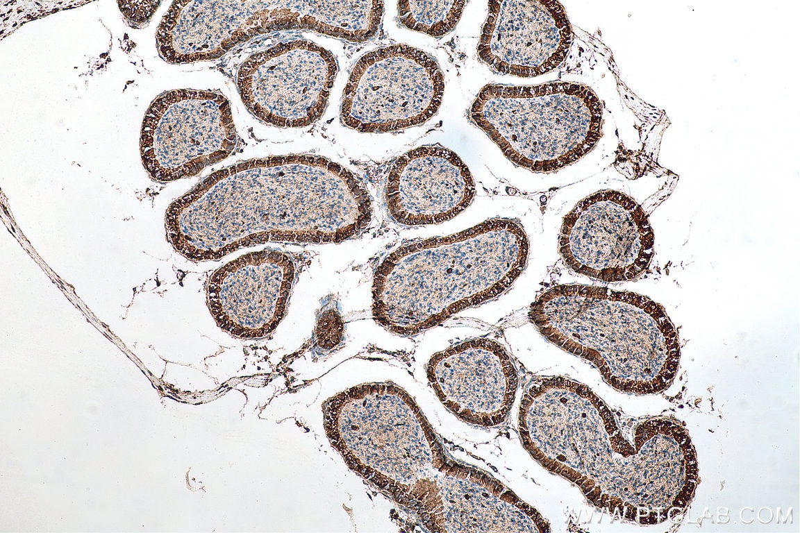 Immunohistochemistry (IHC) staining of mouse testis tissue using SIL1 Polyclonal antibody (24110-1-AP)