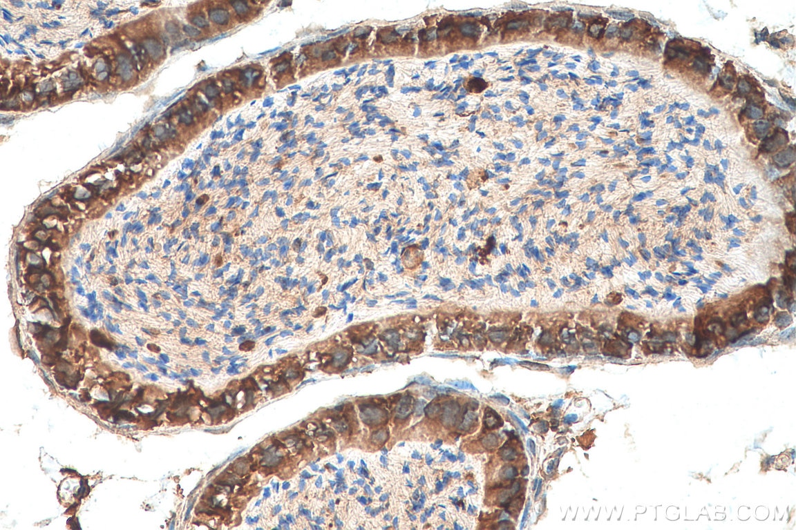 Immunohistochemistry (IHC) staining of mouse testis tissue using SIL1 Polyclonal antibody (24110-1-AP)