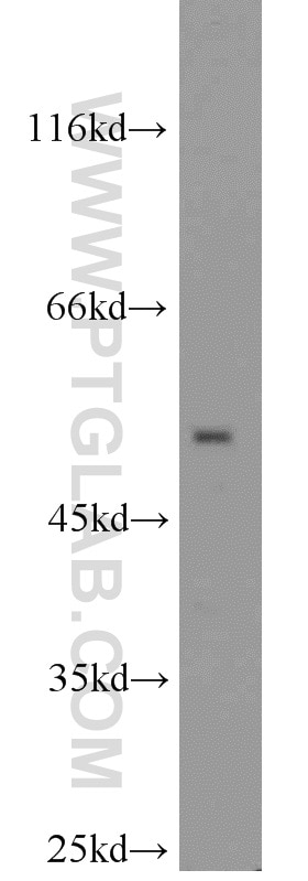 Western Blot (WB) analysis of mouse kidney tissue using SIL1 Polyclonal antibody (24110-1-AP)