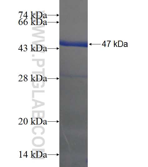 SIL1 fusion protein Ag21367 SDS-PAGE