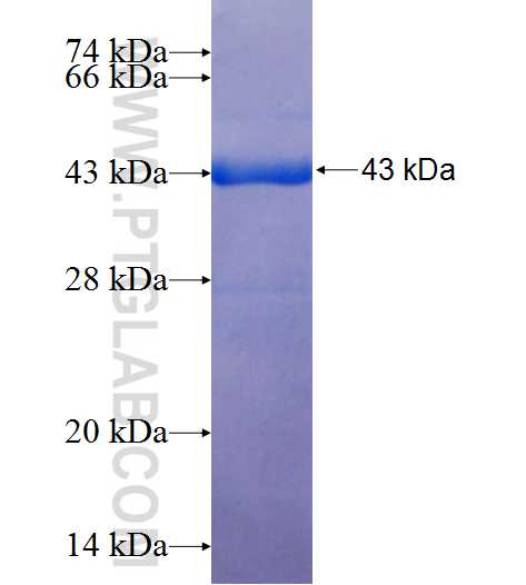 SILV fusion protein Ag25796 SDS-PAGE