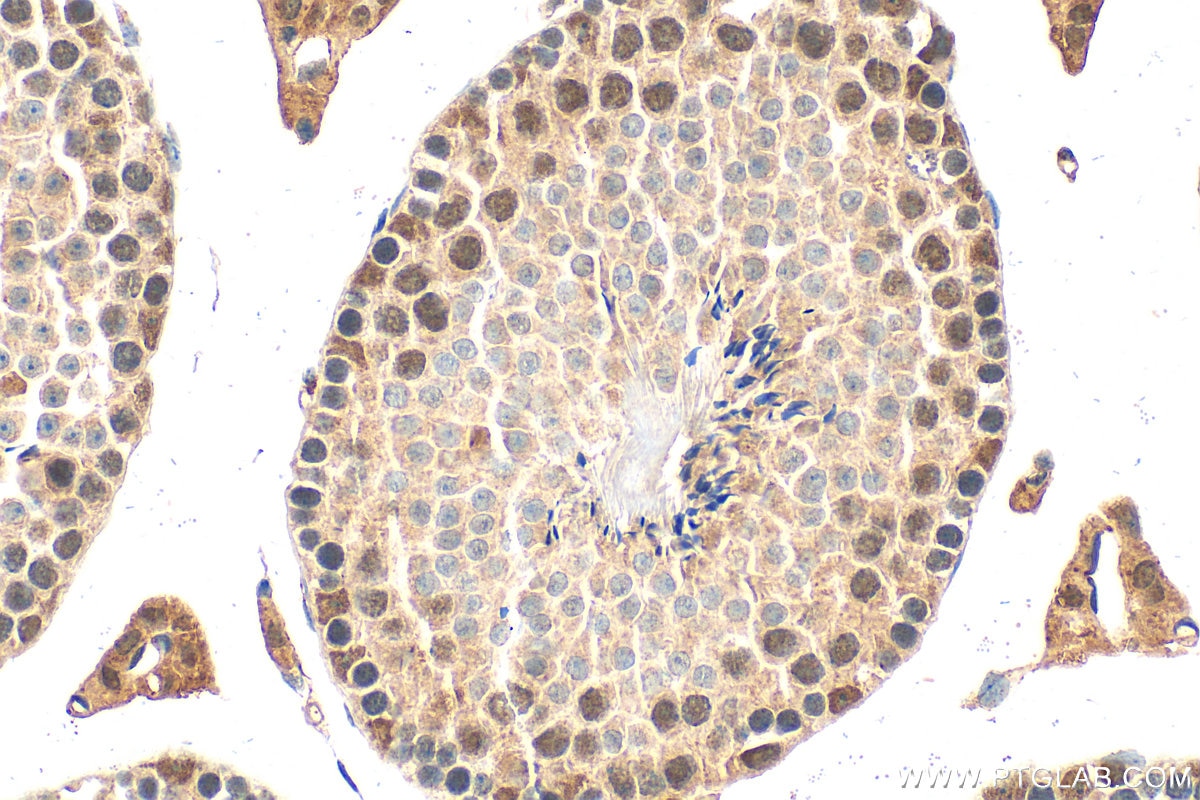 Immunohistochemistry (IHC) staining of mouse testis tissue using SIM2 Polyclonal antibody (21069-1-AP)