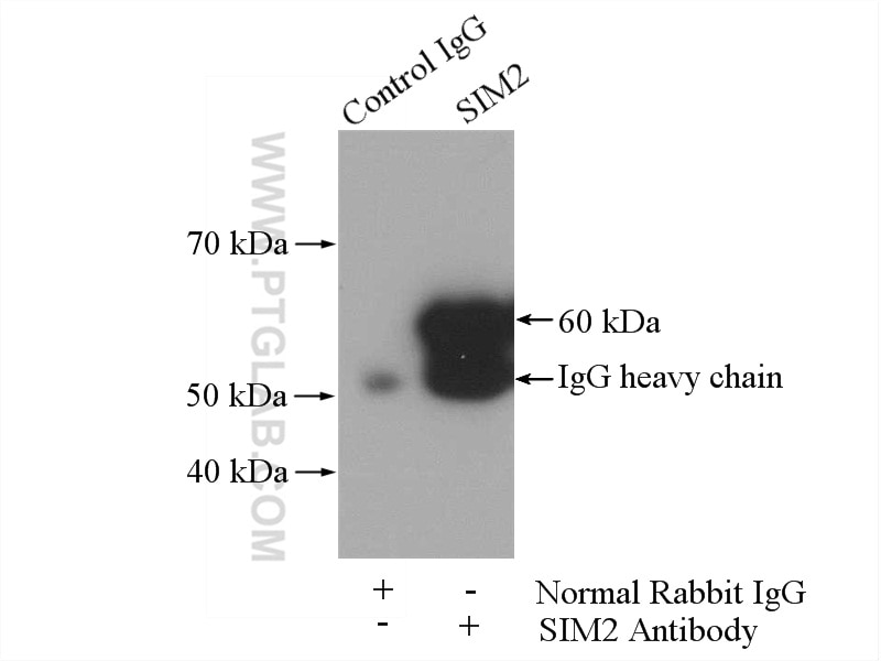 Immunoprecipitation (IP) experiment of mouse skeletal muscle tissue using SIM2 Polyclonal antibody (21069-1-AP)