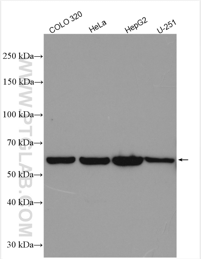 Western Blot (WB) analysis of various lysates using SIM2 Polyclonal antibody (21069-1-AP)