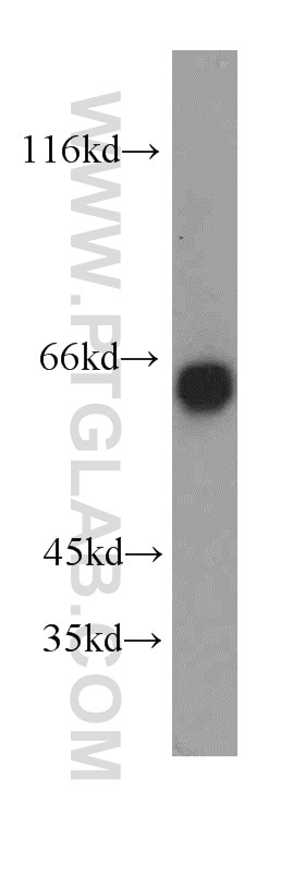 Western Blot (WB) analysis of human skeletal muscle tissue using SIM2 Polyclonal antibody (21069-1-AP)