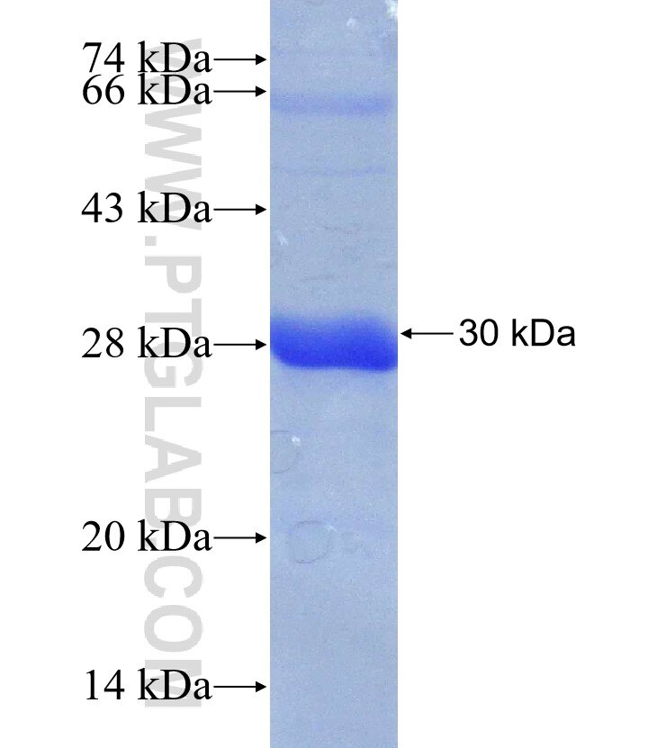 SIM2 fusion protein Ag31170 SDS-PAGE