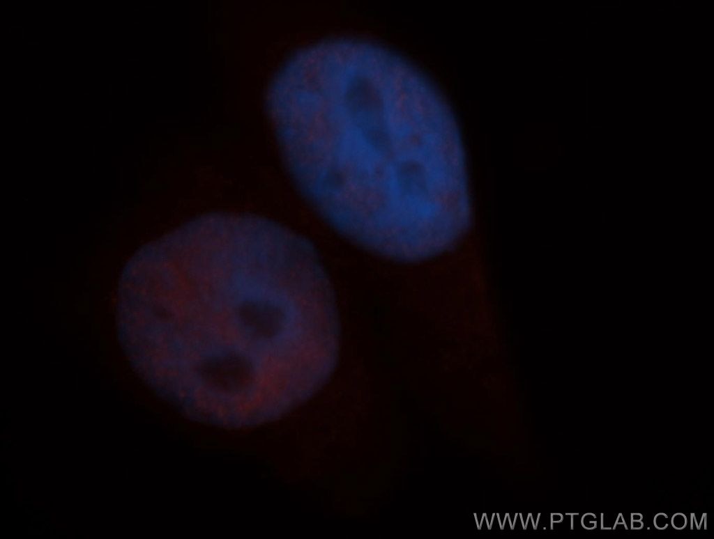 Immunofluorescence (IF) / fluorescent staining of HepG2 cells using SIN3A Polyclonal antibody (14638-1-AP)