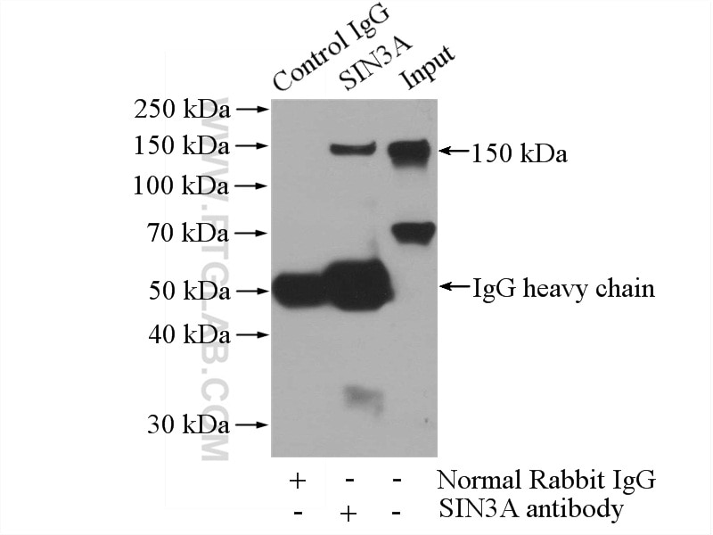 Immunoprecipitation (IP) experiment of Jurkat cells using SIN3A Polyclonal antibody (14638-1-AP)