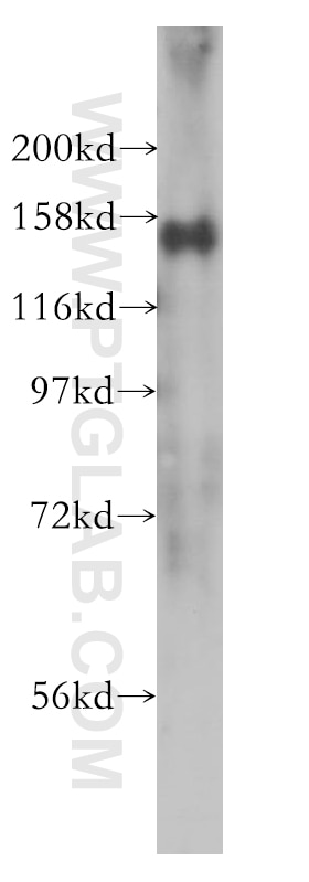 Western Blot (WB) analysis of HeLa cells using SIN3A Polyclonal antibody (14638-1-AP)