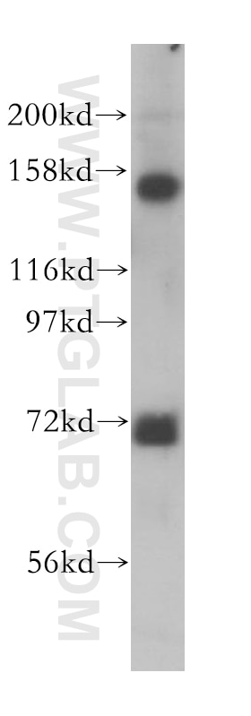 Western Blot (WB) analysis of HEK-293 cells using SIN3A Polyclonal antibody (14638-1-AP)