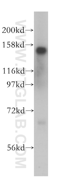Western Blot (WB) analysis of K-562 cells using SIN3A Polyclonal antibody (14638-1-AP)