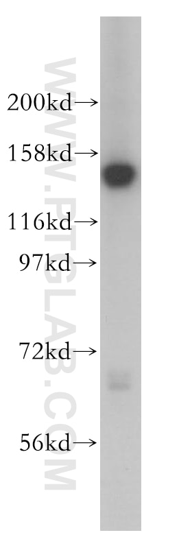 Western Blot (WB) analysis of Jurkat cells using SIN3A Polyclonal antibody (14638-1-AP)