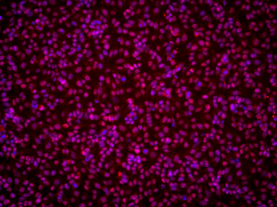 Immunofluorescence (IF) / fluorescent staining of U2OS cells using SIN3A Monoclonal antibody (67197-1-Ig)