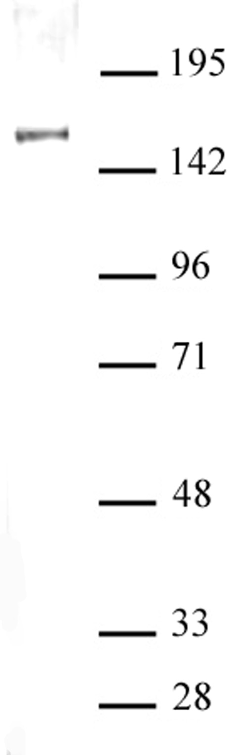 SIN3A antibody (pAb) tested by Western blot. Nuclear extract of HeLa cells (20 μg) probed with SIN3A antibody at a dilution of 1:5,000.