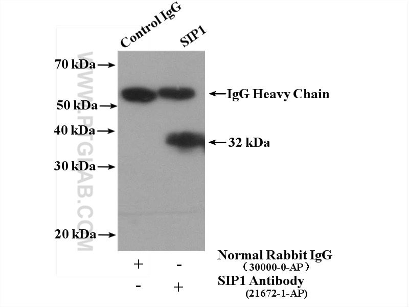Immunoprecipitation (IP) experiment of HepG2 cells using SIP1 Polyclonal antibody (21672-1-AP)