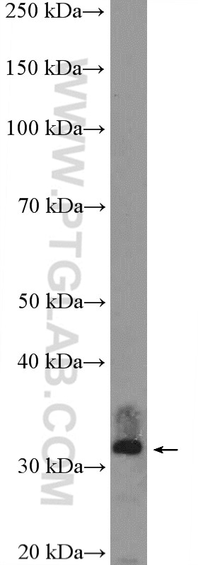 Western Blot (WB) analysis of rat brain tissue using SIP1 Polyclonal antibody (21672-1-AP)