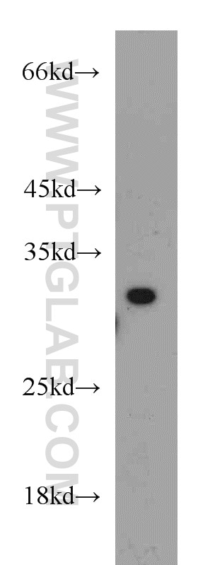 WB analysis of HeLa using 21672-1-AP