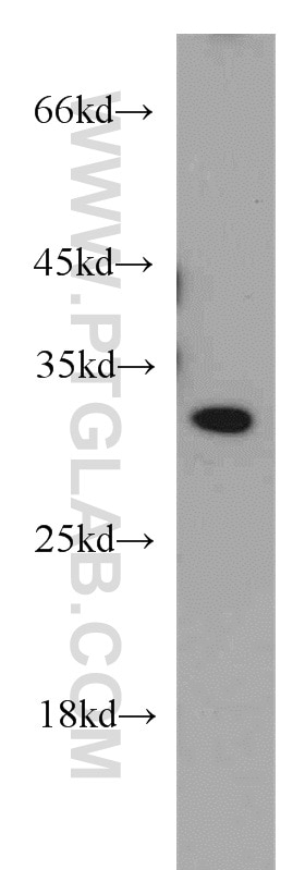 WB analysis of HepG2 using 21672-1-AP