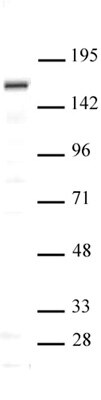SIP1 antibody (pAb) tested by Western blot Nuclear extract of Saos-2 cells (20 ug per lane) probed with SIP1 antibody (pAb) at a dilution of 1:500. SIP1 antibody (pAb) tested by Western blot Nuclear extract of Saos-2 cells (20 ug per lane) probed with SIP1 antibody (pAb) at a dilution of 1:500.