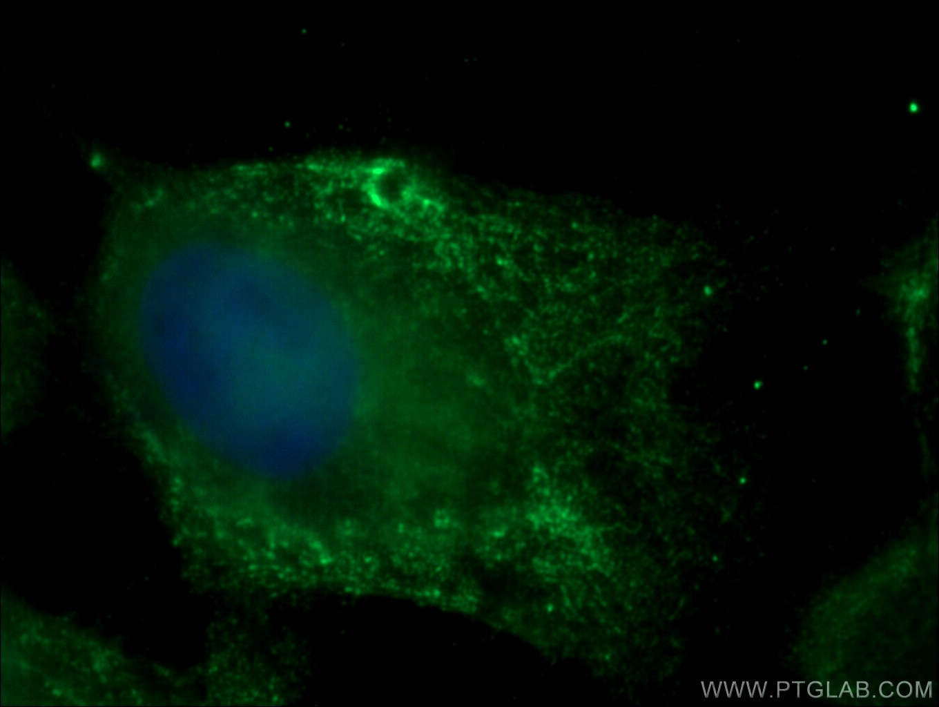 Immunofluorescence (IF) / fluorescent staining of A431 cells using SIPA1 Polyclonal antibody (26793-1-AP)