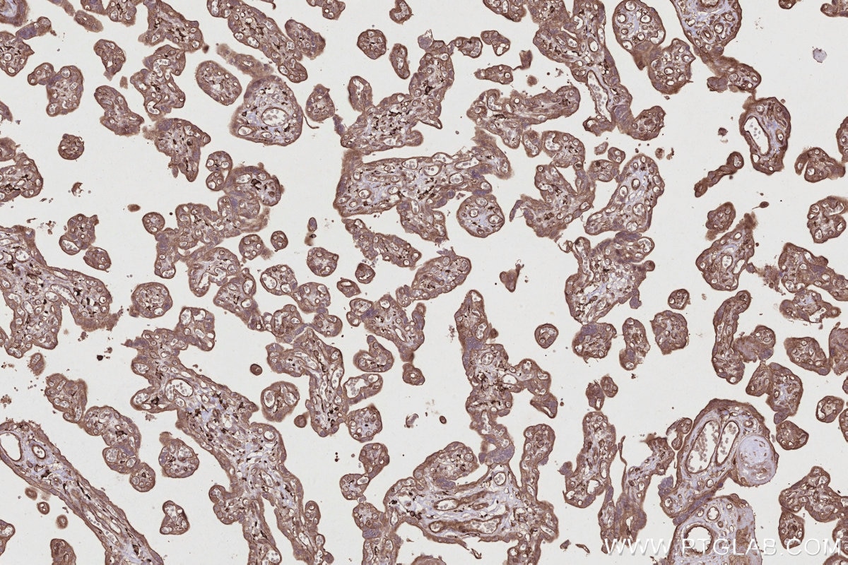 Immunohistochemistry (IHC) staining of human placenta tissue using SIPA1 Polyclonal antibody (26793-1-AP)