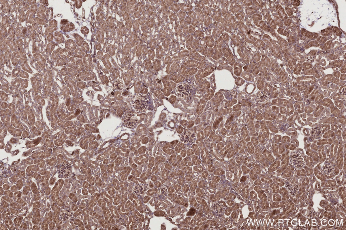 Immunohistochemistry (IHC) staining of mouse kidney tissue using SIPA1 Polyclonal antibody (26793-1-AP)