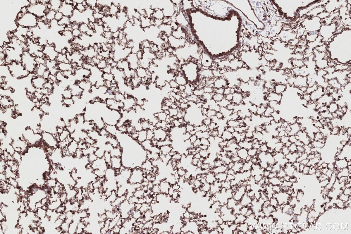Immunohistochemistry (IHC) staining of mouse lung tissue using SIPA1 Polyclonal antibody (26793-1-AP)