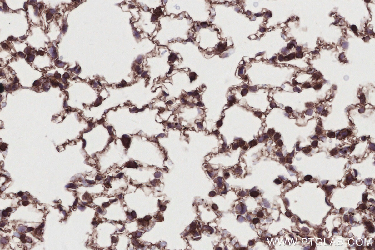 IHC staining of mouse lung using 26793-1-AP Immunohistochemistry (IHC) staining of mouse lung tissue using SIPA1 Polyclonal antibody (26793-1-AP)