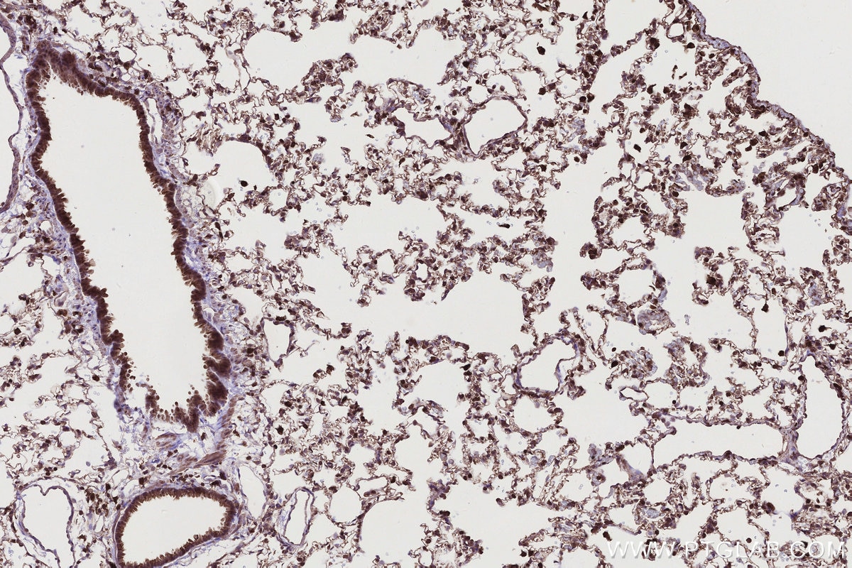 Immunohistochemistry (IHC) staining of rat lung tissue using SIPA1 Polyclonal antibody (26793-1-AP)