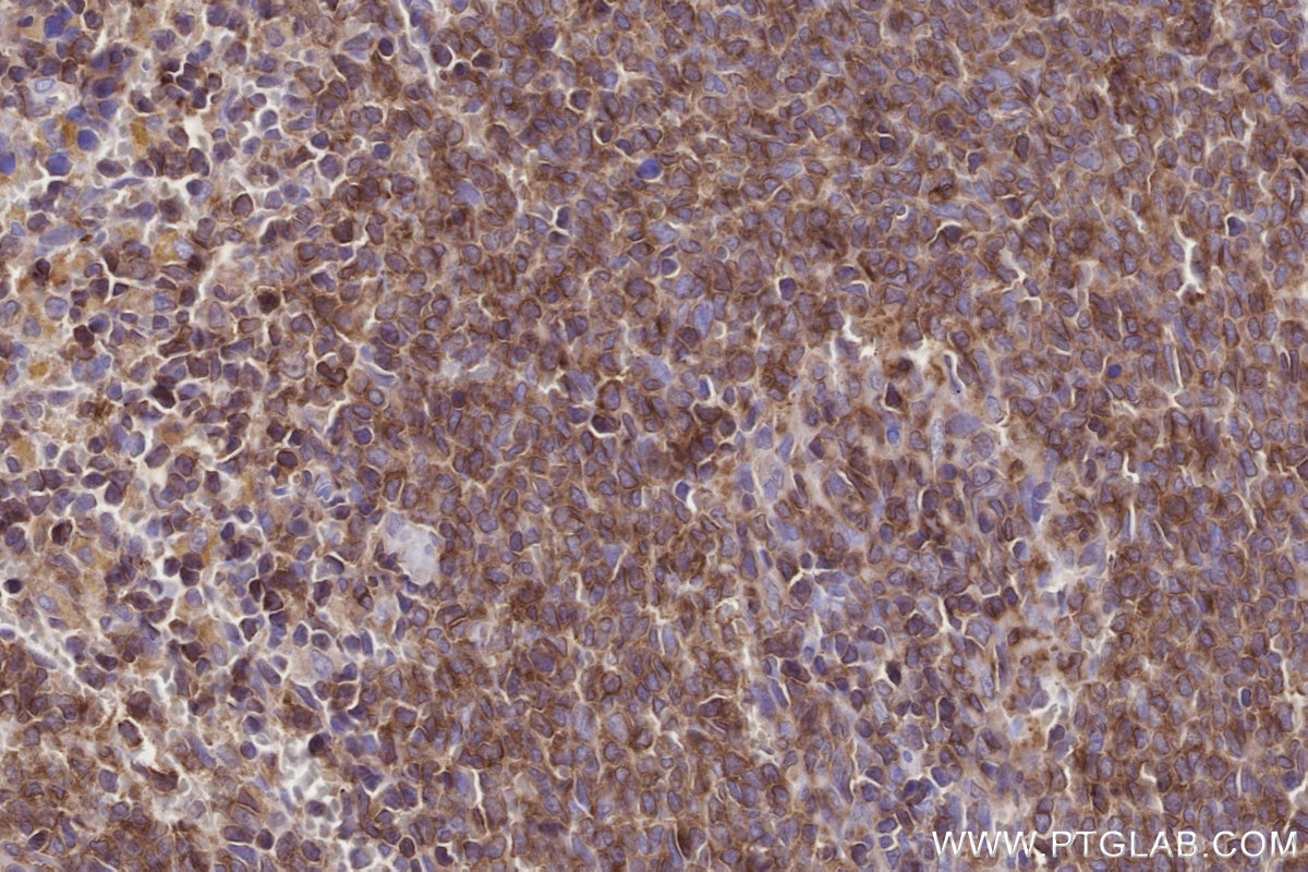 Immunohistochemistry (IHC) staining of rat spleen tissue using SIPA1 Polyclonal antibody (26793-1-AP)