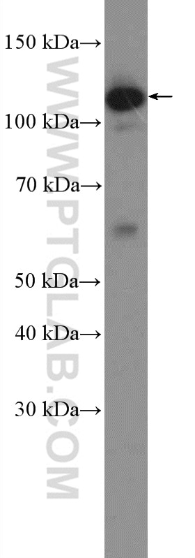 Western Blot (WB) analysis of HEK-293T cells using SIPA1 Polyclonal antibody (26793-1-AP)
