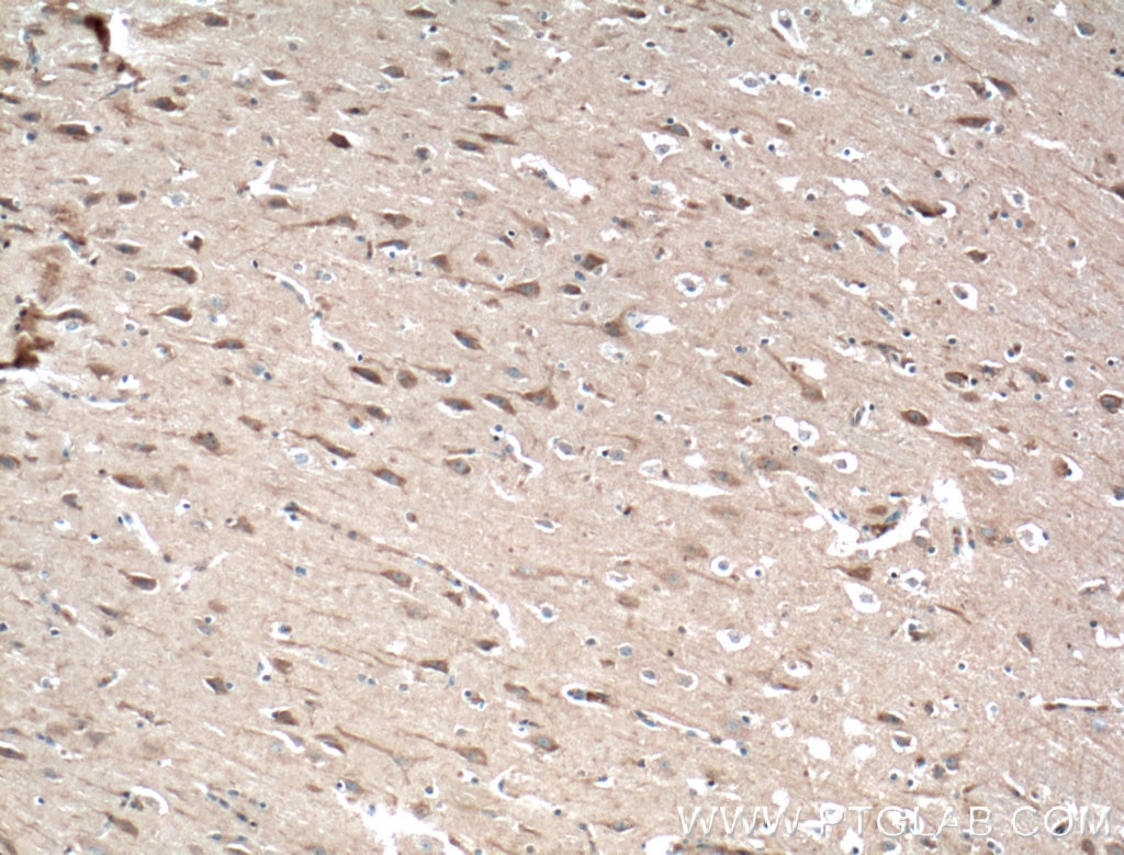 Immunohistochemistry (IHC) staining of human brain tissue using SIPA1L1 Polyclonal antibody (25086-1-AP)