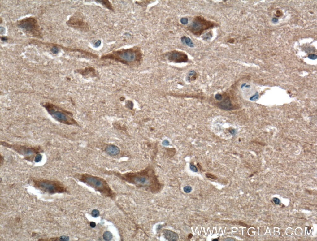 Immunohistochemistry (IHC) staining of human brain tissue using SIPA1L1 Polyclonal antibody (25086-1-AP)