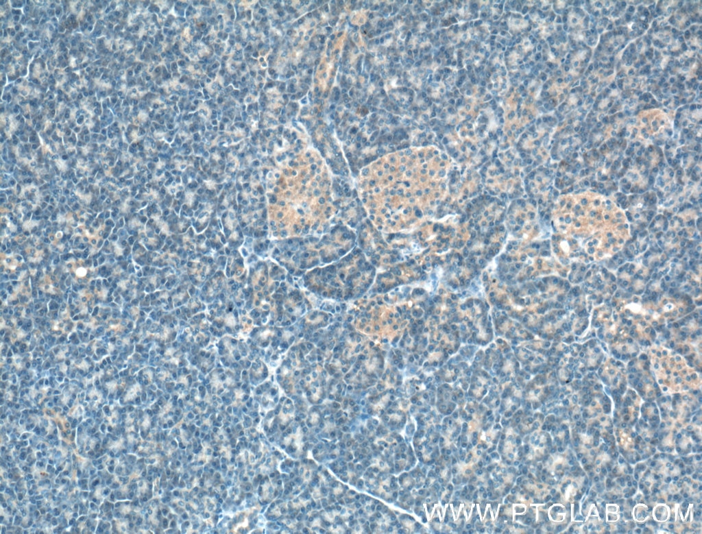Immunohistochemistry (IHC) staining of human pancreas tissue using SIPA1L1 Polyclonal antibody (25086-1-AP)