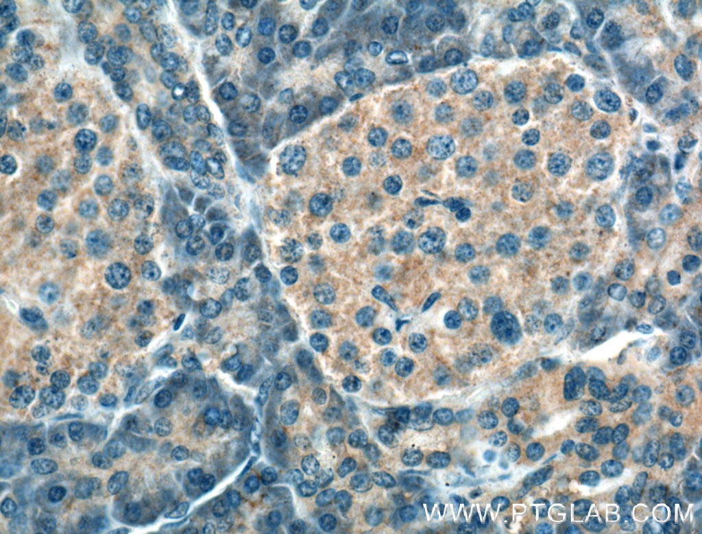 Immunohistochemistry (IHC) staining of human pancreas tissue using SIPA1L1 Polyclonal antibody (25086-1-AP)