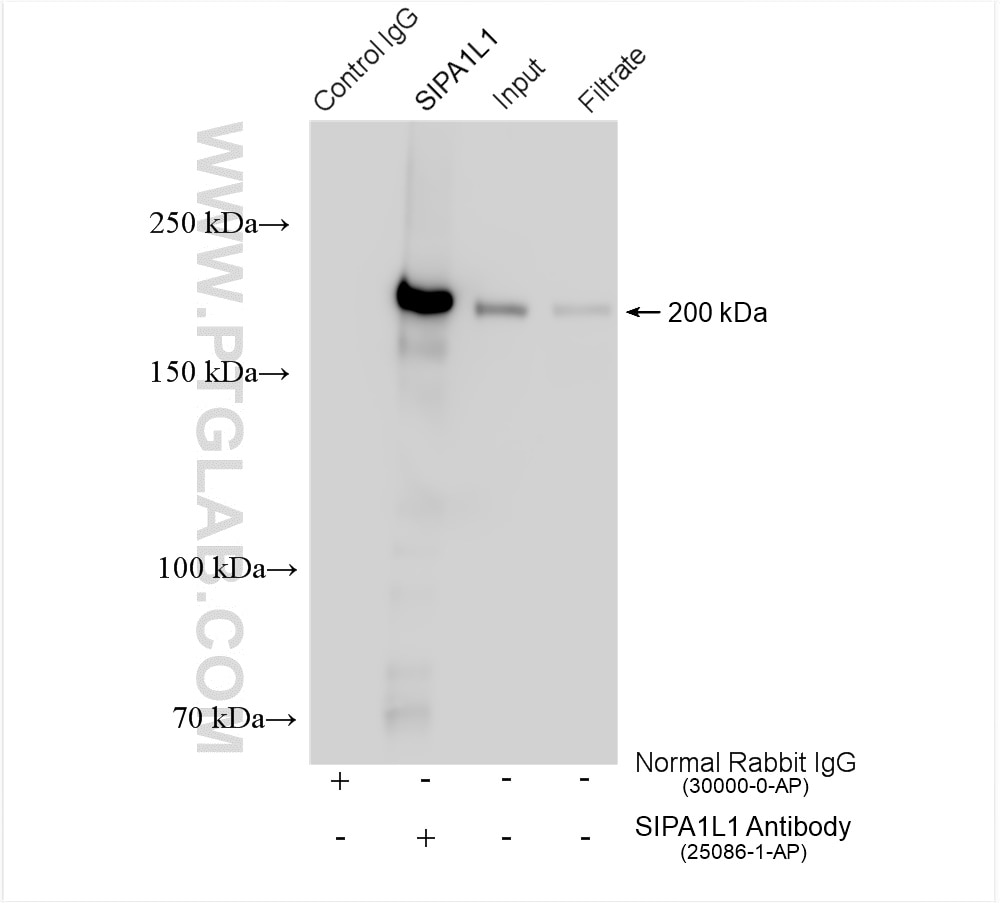 Immunoprecipitation (IP) experiment of mouse brain tissue using SIPA1L1 Polyclonal antibody (25086-1-AP)