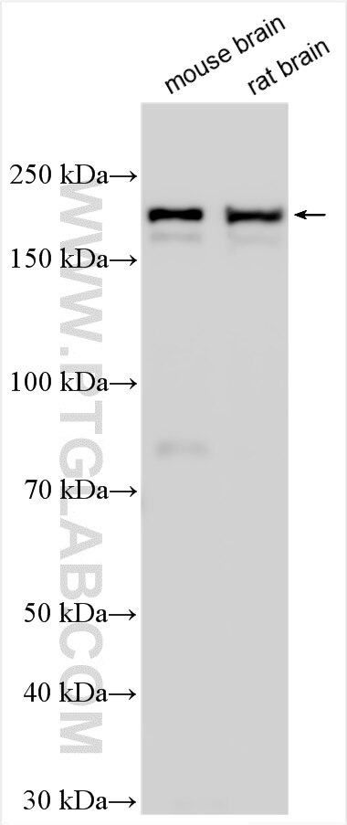Western Blot (WB) analysis of various lysates using SIPA1L1 Polyclonal antibody (25086-1-AP)