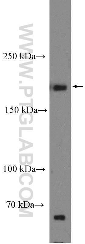 Western Blot (WB) analysis of HeLa cells using SIPA1L1 Polyclonal antibody (25086-1-AP)