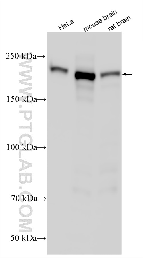 Western Blot (WB) analysis of various lysates using SIPA1L1 Polyclonal antibody (25086-1-AP)