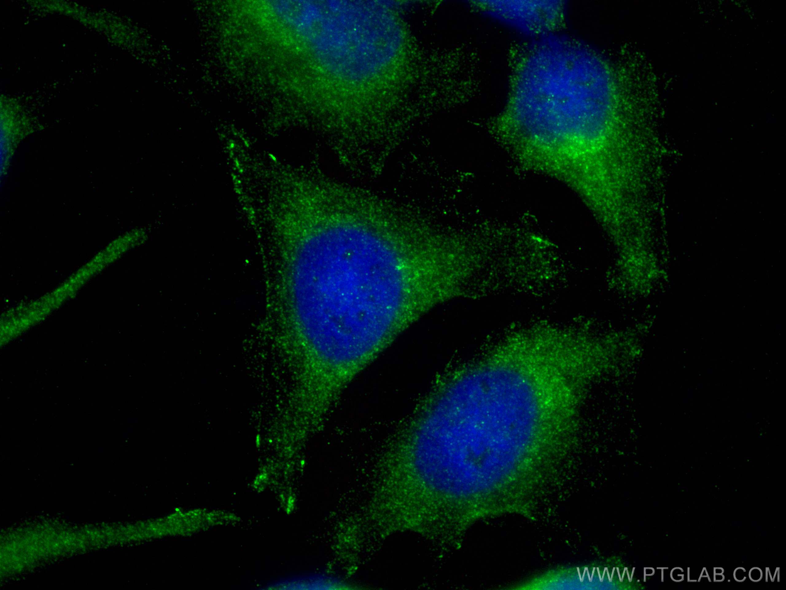 Immunofluorescence (IF) / fluorescent staining of HeLa cells using SIPA1L3 Polyclonal antibody (30544-1-AP)